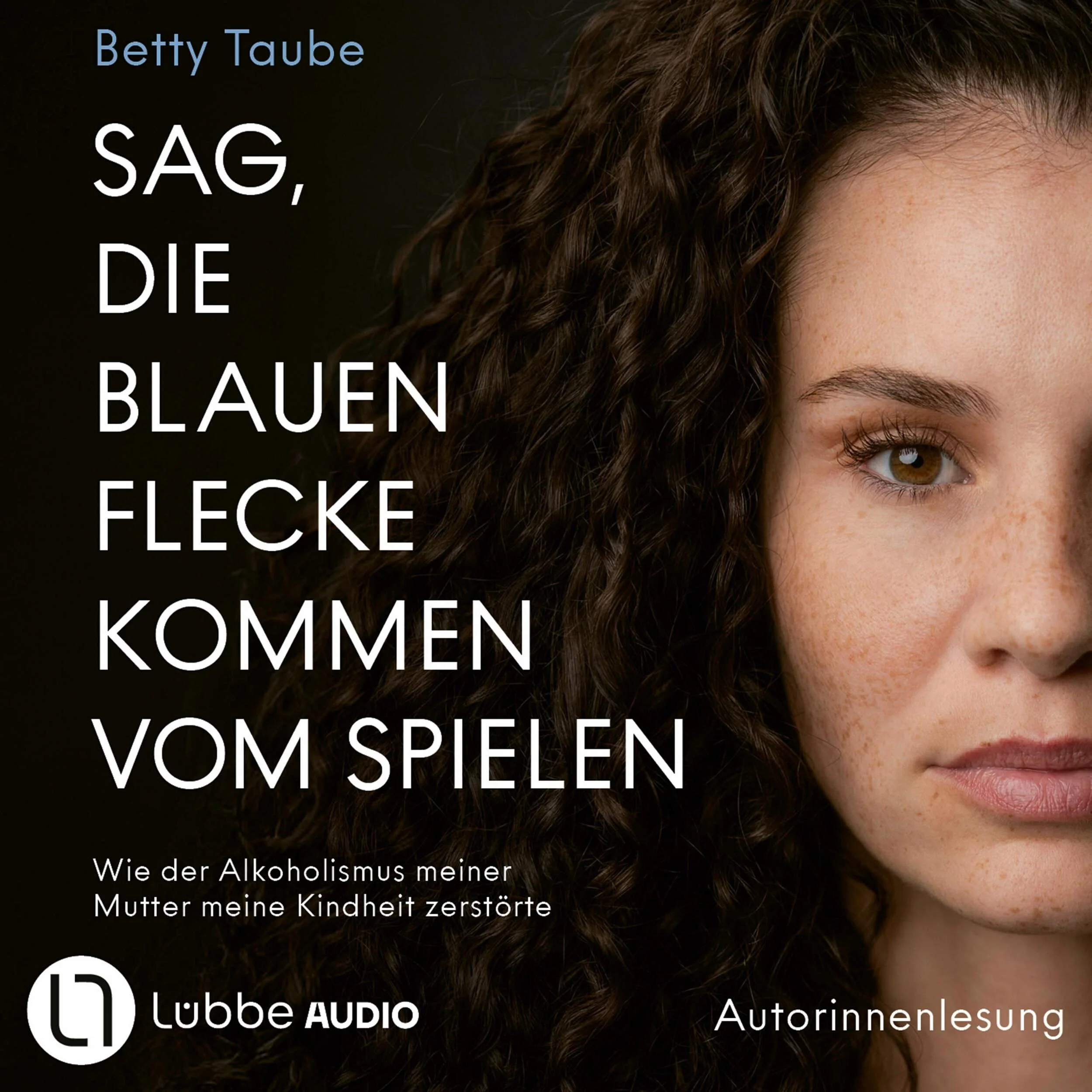 Sag, die blauen Flecke kommen vom Spielen - Wie der Alkoholismus meiner Mutter meine Kindheit zerstörte von Betty Taube (Ungekürzt)